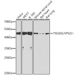 Western Blot - Anti-TSG101 Antibody (A13598) - Antibodies.com