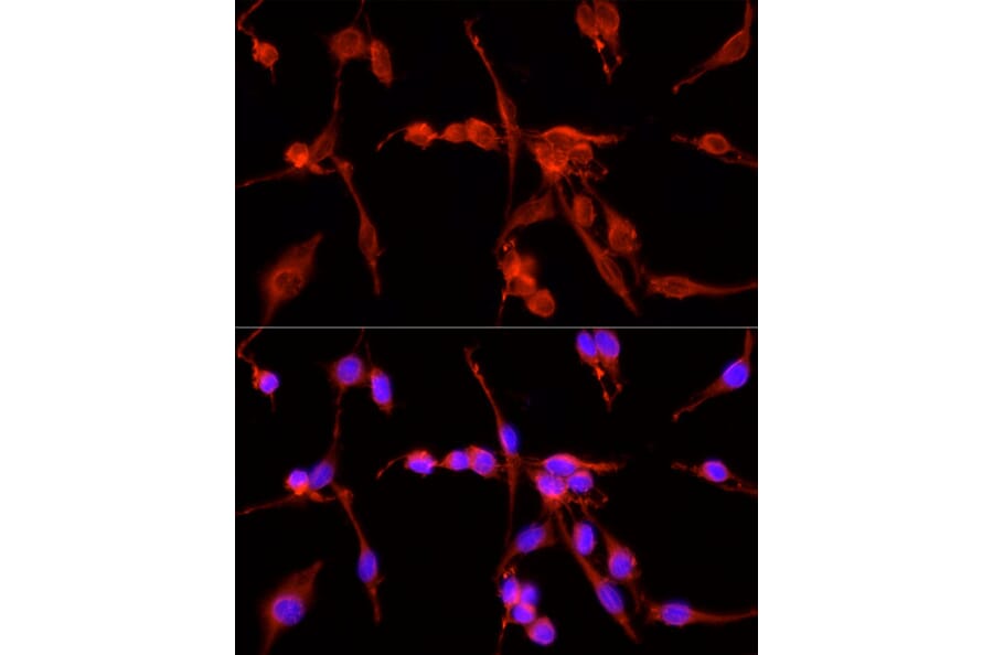 Immunofluorescence - Anti-TSG101 Antibody (A13598) - Antibodies.com