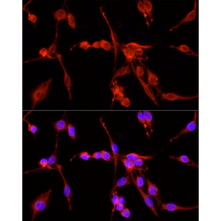 Immunofluorescence - Anti-TSG101 Antibody (A13598) - Antibodies.com