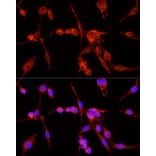 Immunofluorescence - Anti-TSG101 Antibody (A13598) - Antibodies.com