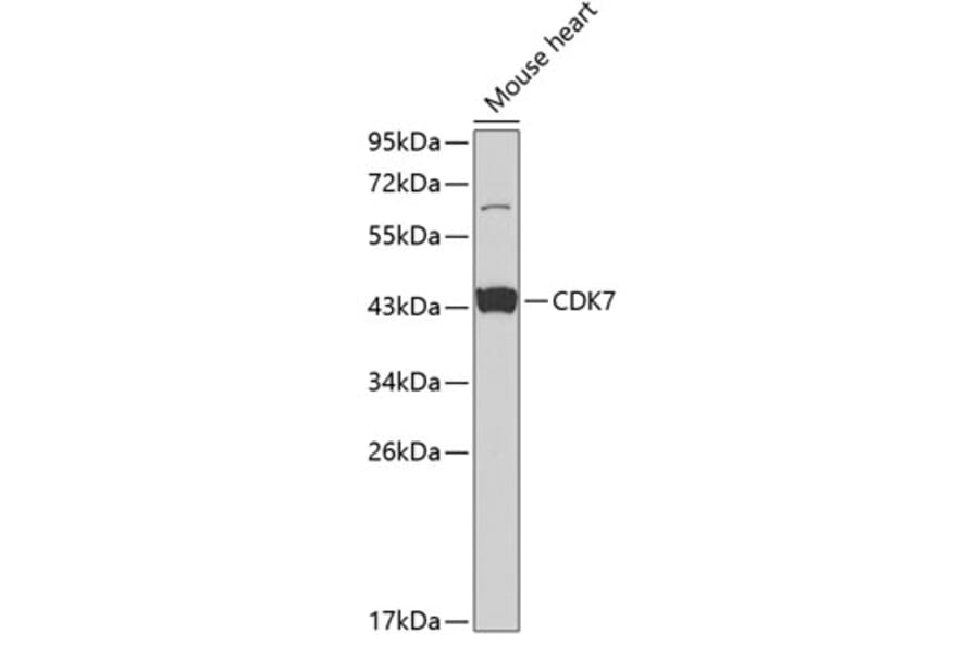 Western Blot - Anti-Cdk7 Antibody (A13599) - Antibodies.com