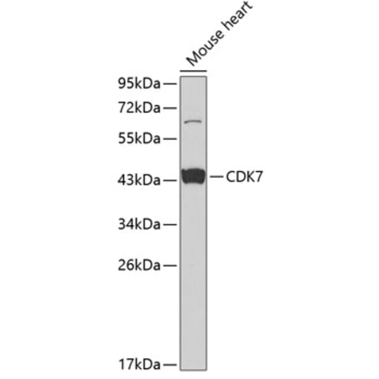 Western Blot - Anti-Cdk7 Antibody (A13599) - Antibodies.com