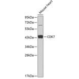 Western Blot - Anti-Cdk7 Antibody (A13599) - Antibodies.com