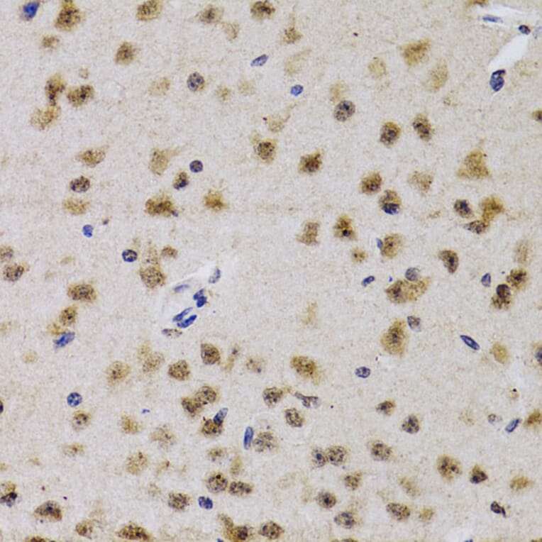 Immunohistochemistry - Anti-Cdk7 Antibody (A13599) - Antibodies.com