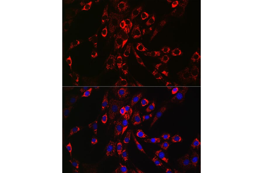 Immunofluorescence - Anti-HBEGF/DTR Antibody (A13600) - Antibodies.com