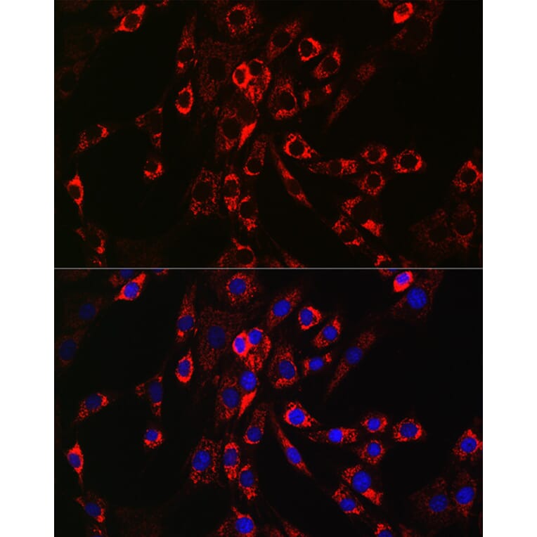 Immunofluorescence - Anti-HBEGF/DTR Antibody (A13600) - Antibodies.com