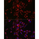 Immunofluorescence - Anti-HBEGF/DTR Antibody (A13600) - Antibodies.com
