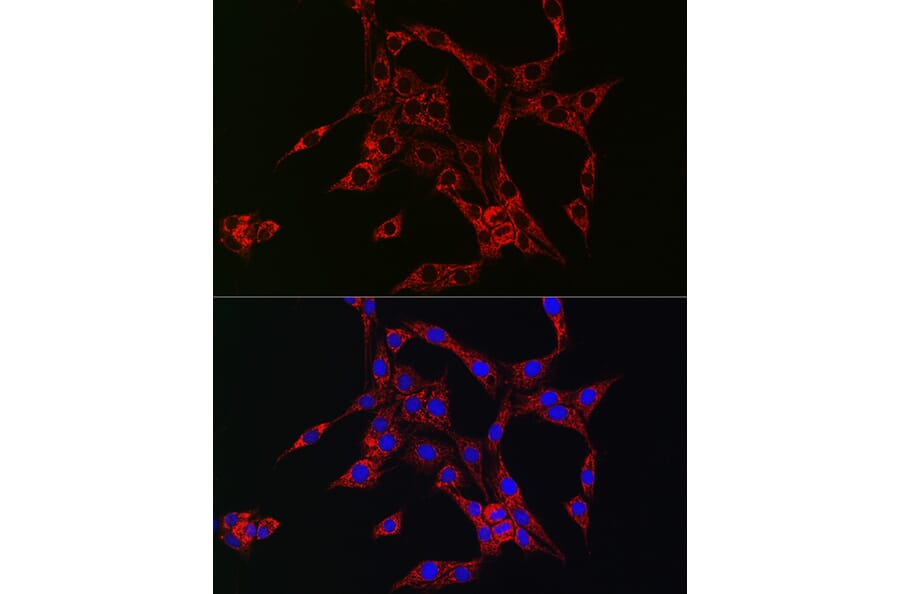 Immunofluorescence - Anti-HBEGF/DTR Antibody (A13600) - Antibodies.com
