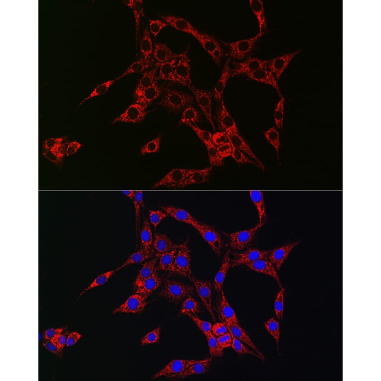 Immunofluorescence - Anti-HBEGF/DTR Antibody (A13600) - Antibodies.com