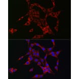 Immunofluorescence - Anti-HBEGF/DTR Antibody (A13600) - Antibodies.com