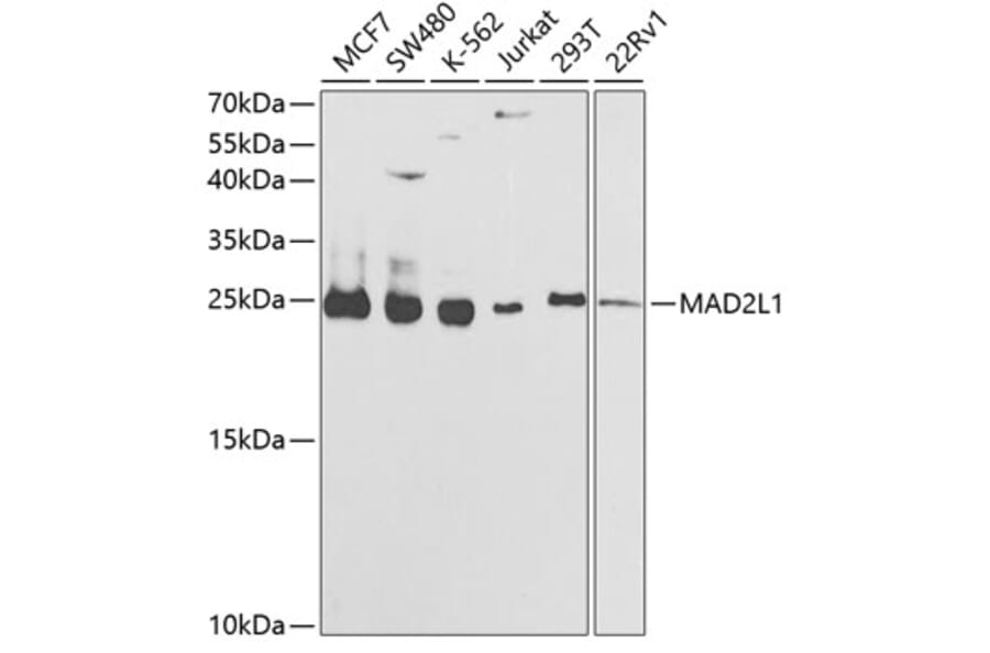 Western Blot - Anti-MAD2L1 Antibody (A1699) - Antibodies.com