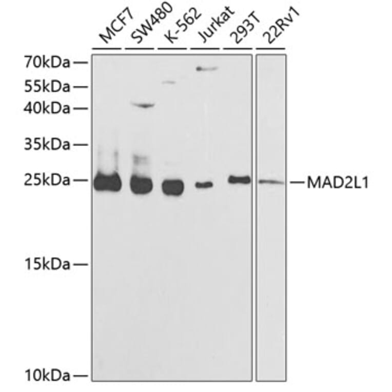 Western Blot - Anti-MAD2L1 Antibody (A1699) - Antibodies.com