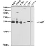 Western Blot - Anti-MAD2L1 Antibody (A1699) - Antibodies.com