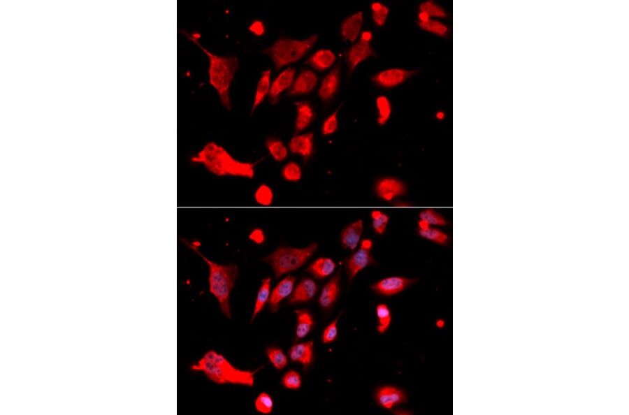 Immunofluorescence - Anti-MAD2L1 Antibody (A1699) - Antibodies.com