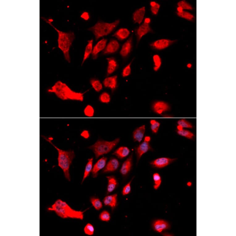 Immunofluorescence - Anti-MAD2L1 Antibody (A1699) - Antibodies.com