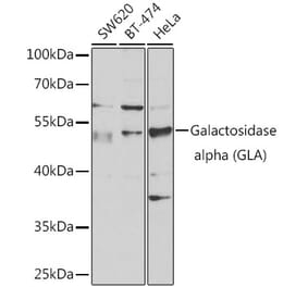 Western Blot - Anti-Galactosidase alpha Antibody (A13602) - Antibodies.com