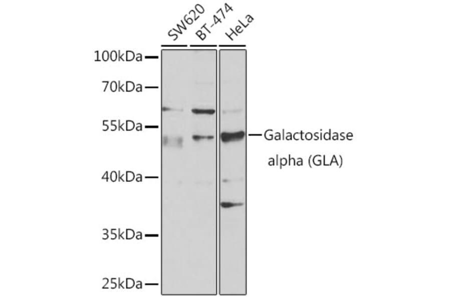 Western Blot - Anti-Galactosidase alpha Antibody (A13602) - Antibodies.com