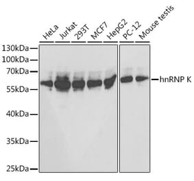 Western Blot - Anti-hnRNP K Antibody (A13603) - Antibodies.com