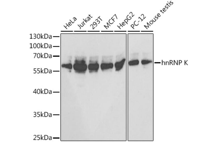 Western Blot - Anti-hnRNP K Antibody (A13603) - Antibodies.com