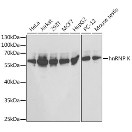 Western Blot - Anti-hnRNP K Antibody (A13603) - Antibodies.com