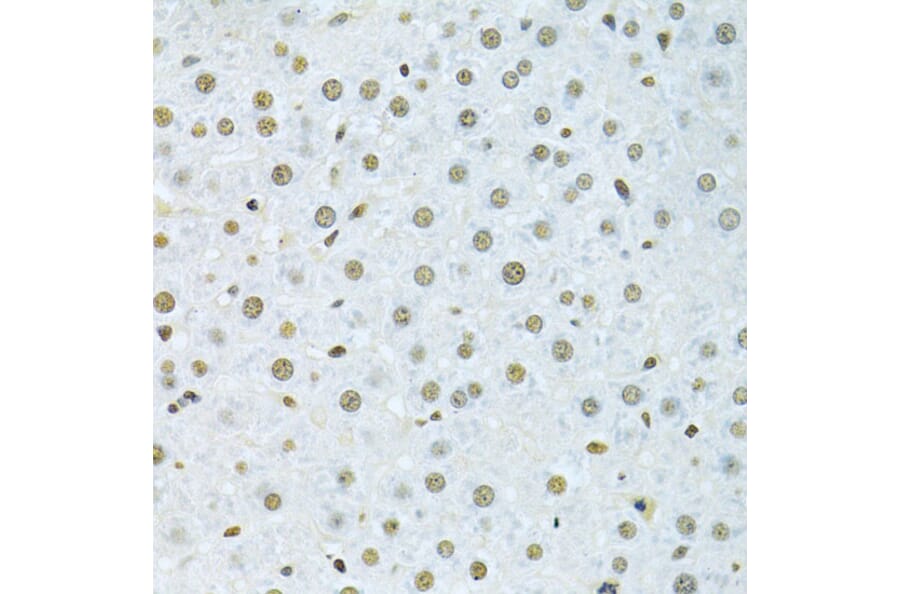 Immunohistochemistry - Anti-hnRNP K Antibody (A13603) - Antibodies.com