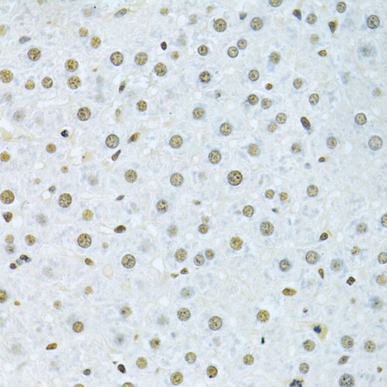Immunohistochemistry - Anti-hnRNP K Antibody (A13603) - Antibodies.com