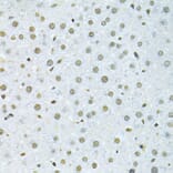 Immunohistochemistry - Anti-hnRNP K Antibody (A13603) - Antibodies.com