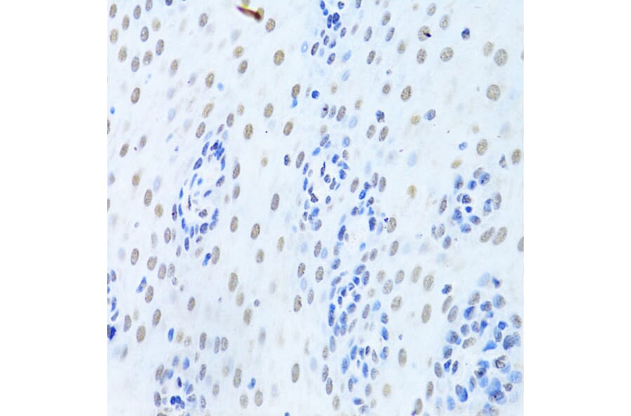 Immunohistochemistry - Anti-hnRNP K Antibody (A13603) - Antibodies.com