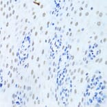 Immunohistochemistry - Anti-hnRNP K Antibody (A13603) - Antibodies.com