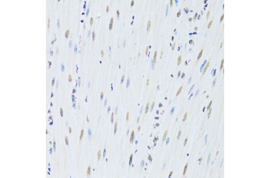 Immunohistochemistry - Anti-hnRNP K Antibody (A13603) - Antibodies.com