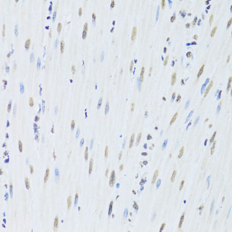Immunohistochemistry - Anti-hnRNP K Antibody (A13603) - Antibodies.com