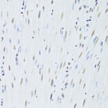 Immunohistochemistry - Anti-hnRNP K Antibody (A13603) - Antibodies.com