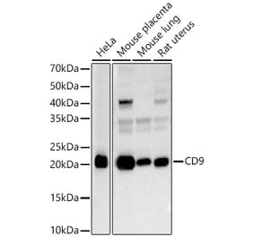 Western Blot - Anti-CD9 Antibody (A13604) - Antibodies.com