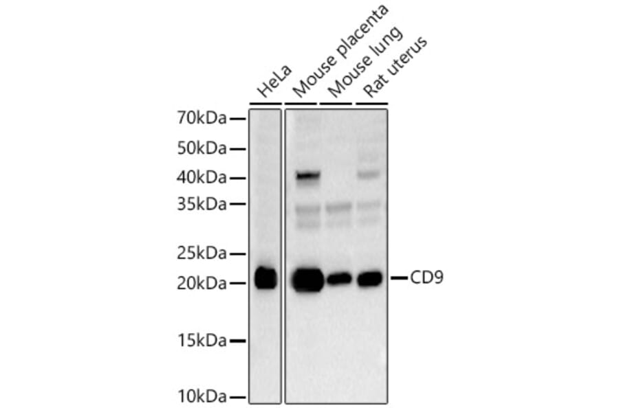 Western Blot - Anti-CD9 Antibody (A13604) - Antibodies.com