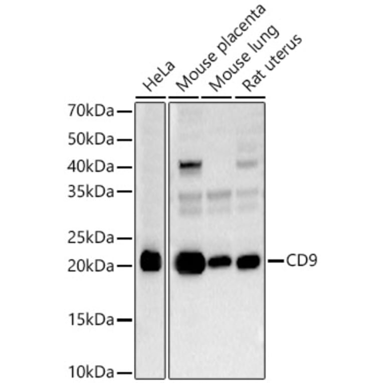 Western Blot - Anti-CD9 Antibody (A13604) - Antibodies.com