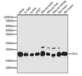 Western Blot - Anti-Cofilin Antibody (A13605) - Antibodies.com