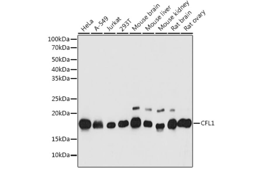 Western Blot - Anti-Cofilin Antibody (A13605) - Antibodies.com