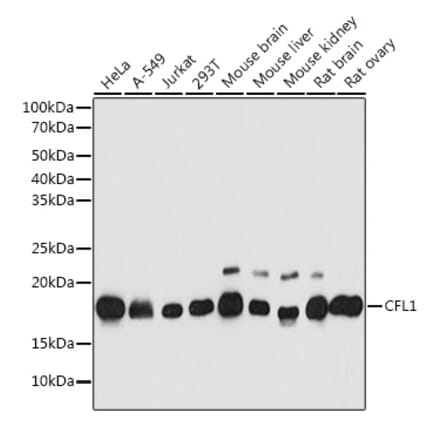 Western Blot - Anti-Cofilin Antibody (A13605) - Antibodies.com