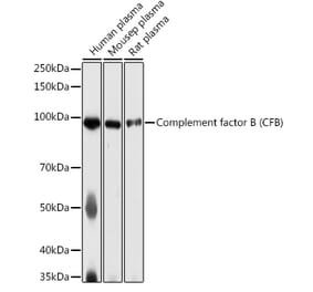 Western Blot - Anti-Complement factor B Antibody (A13606) - Antibodies.com