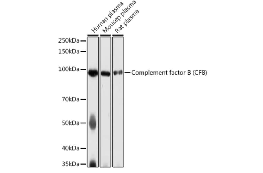 Western Blot - Anti-Complement factor B Antibody (A13606) - Antibodies.com