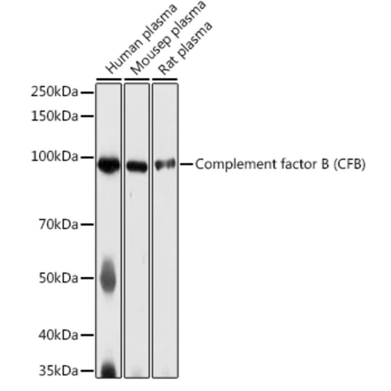 Western Blot - Anti-Complement factor B Antibody (A13606) - Antibodies.com