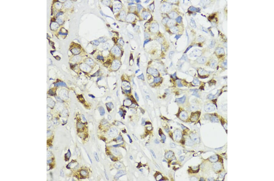 Immunohistochemistry - Anti-Complement factor B Antibody (A13606) - Antibodies.com