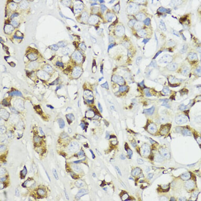 Immunohistochemistry - Anti-Complement factor B Antibody (A13606) - Antibodies.com