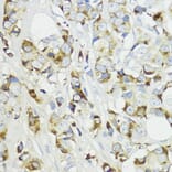 Immunohistochemistry - Anti-Complement factor B Antibody (A13606) - Antibodies.com