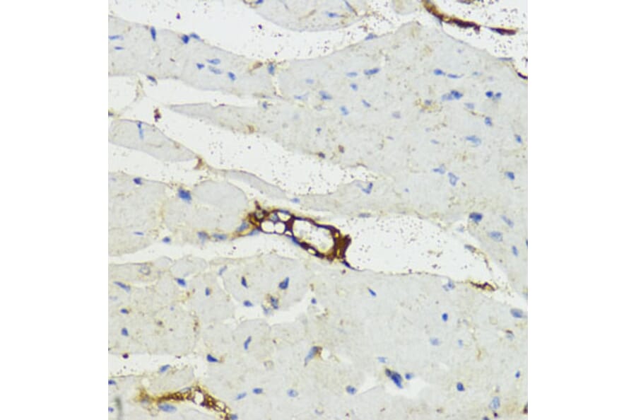 Immunohistochemistry - Anti-Complement factor B Antibody (A13606) - Antibodies.com
