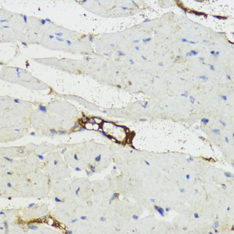 Immunohistochemistry - Anti-Complement factor B Antibody (A13606) - Antibodies.com
