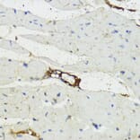 Immunohistochemistry - Anti-Complement factor B Antibody (A13606) - Antibodies.com