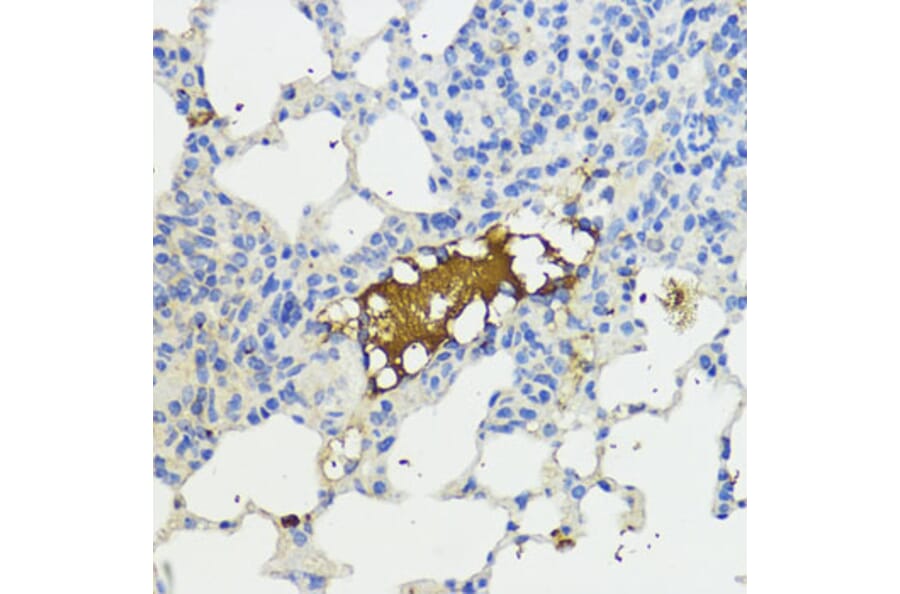 Immunohistochemistry - Anti-Complement factor B Antibody (A13606) - Antibodies.com