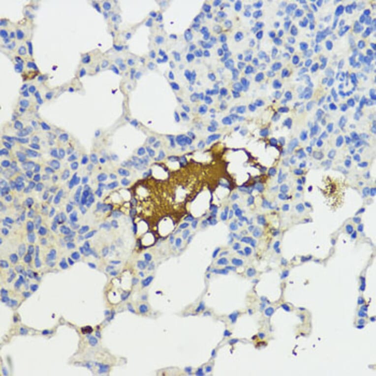Immunohistochemistry - Anti-Complement factor B Antibody (A13606) - Antibodies.com
