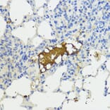 Immunohistochemistry - Anti-Complement factor B Antibody (A13606) - Antibodies.com